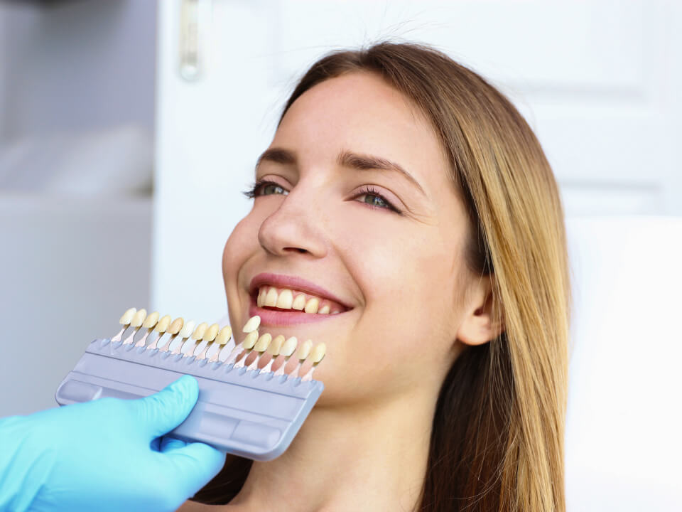 Albire dentară profesională