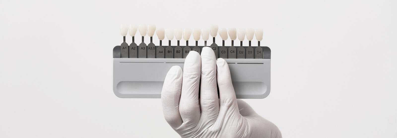 Albirea dentară profesională vs. soluțiile DIY: Ce trebuie să știi