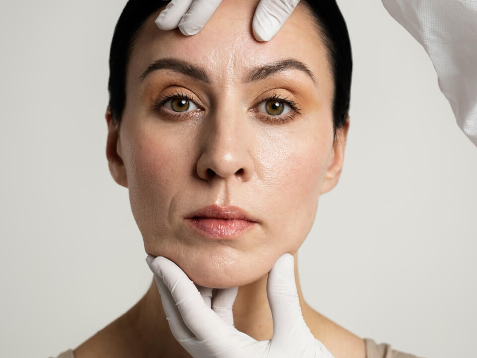 Lifting cu fire PDO (Polidioxanona)